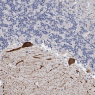 NBP1-86654 - Carbonic anhydrase 8